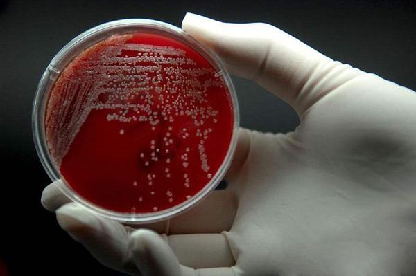 生物中接种方法→平板划线法要注意什么