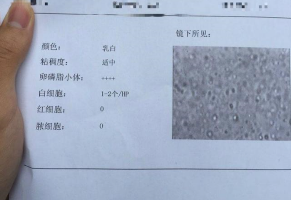 卵磷脂小体正常值是多少