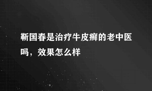 靳国春是治疗牛皮癣的老中医吗，效果怎么样