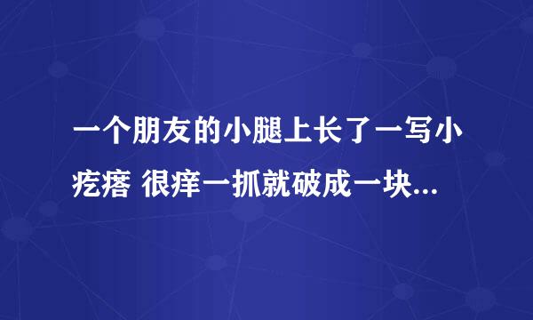 一个朋友的小腿上长了一写小疙瘩 很痒一抓就破成一块块的是怎么了