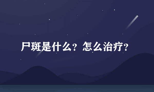 尸斑是什么？怎么治疗？