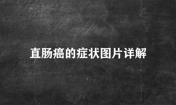 直肠癌的症状图片详解