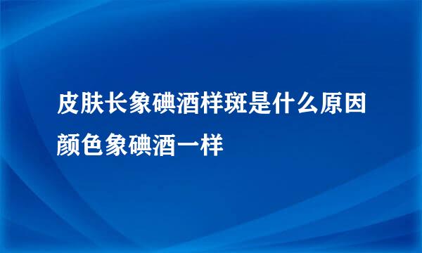 皮肤长象碘酒样斑是什么原因颜色象碘酒一样