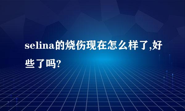 selina的烧伤现在怎么样了,好些了吗?