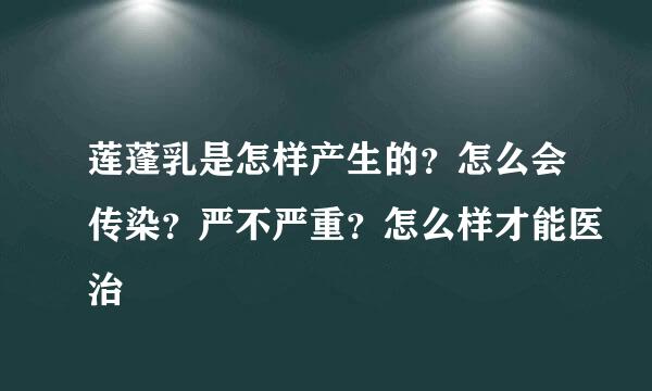 莲蓬乳是怎样产生的？怎么会传染？严不严重？怎么样才能医治