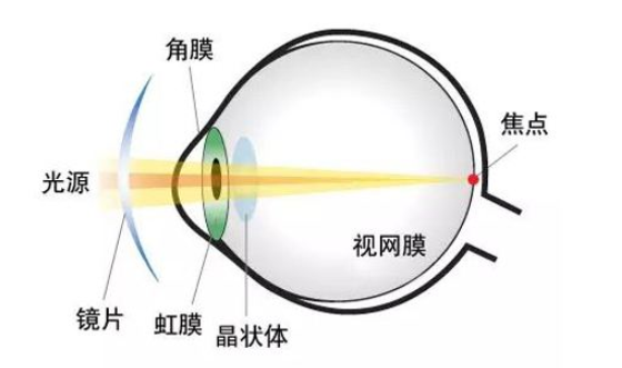 眼的主要结构是什么？