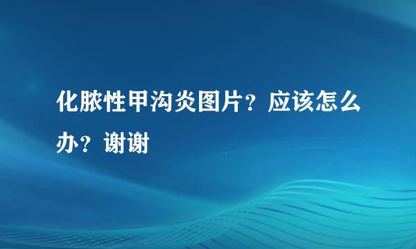 化脓性甲沟炎图片？应该怎么办？谢谢