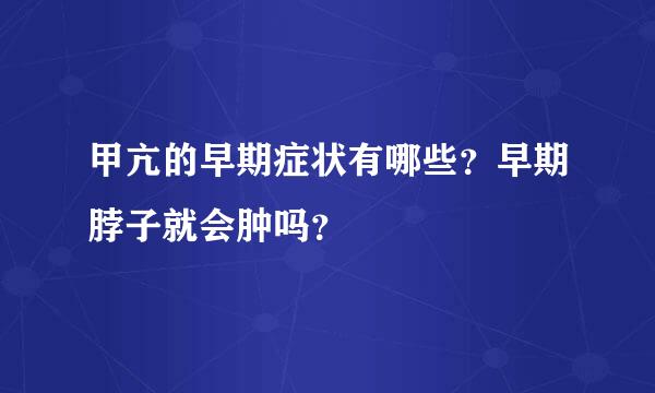 甲亢的早期症状有哪些？早期脖子就会肿吗？