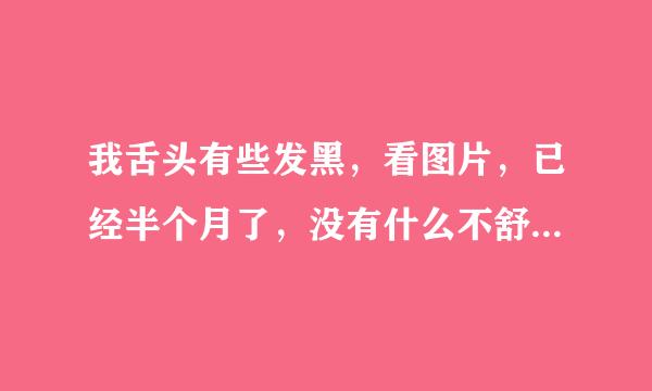 我舌头有些发黑，看图片，已经半个月了，没有什么不舒服，是怎么回事呢？怎么治疗呢？谢谢！