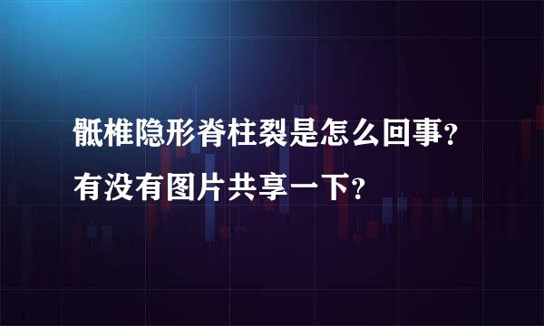 骶椎隐形脊柱裂是怎么回事？有没有图片共享一下？