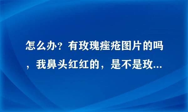 怎么办？有玫瑰痤疮图片的吗，我鼻头红红的，是不是玫瑰痤疮啊谢谢怎么办呢，有玫瑰痤疮图片的吗，我鼻头？