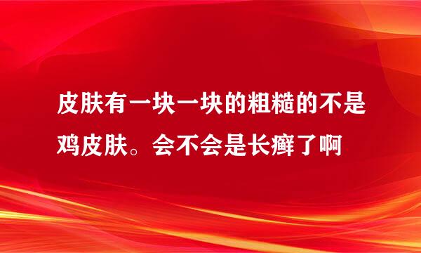 皮肤有一块一块的粗糙的不是鸡皮肤。会不会是长癣了啊