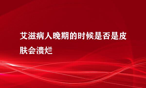 艾滋病人晚期的时候是否是皮肤会溃烂