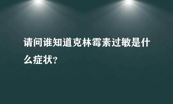 请问谁知道克林霉素过敏是什么症状？