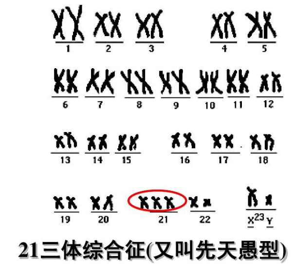 遗传学中的三体是指什么