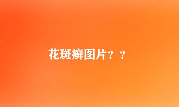 花斑癣图片？？