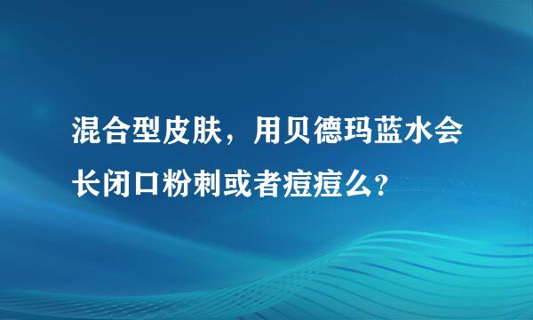 混合型皮肤，用贝德玛蓝水会长闭口粉刺或者痘痘么？