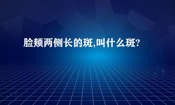 脸颊两侧长的斑,叫什么斑?