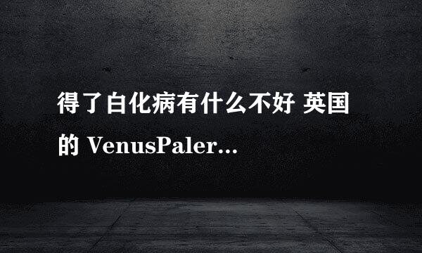 得了白化病有什么不好 英国的 VenusPalermo不是挺好的么