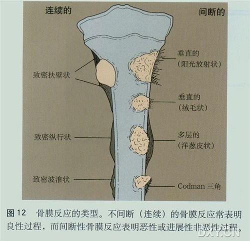 二级反应的分类