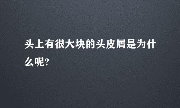 头上有很大块的头皮屑是为什么呢?