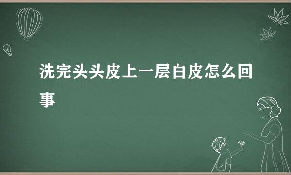 洗完头头皮上一层白皮怎么回事