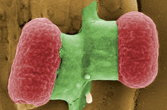 大肠埃希菌O157与大肠杆菌O157区别?