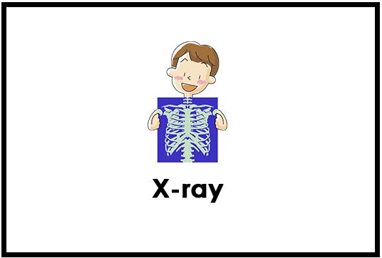 “ray”用中文翻译是什么意思？