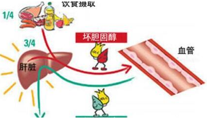 低密度脂蛋白胆固醇高的原因是怎样产生的