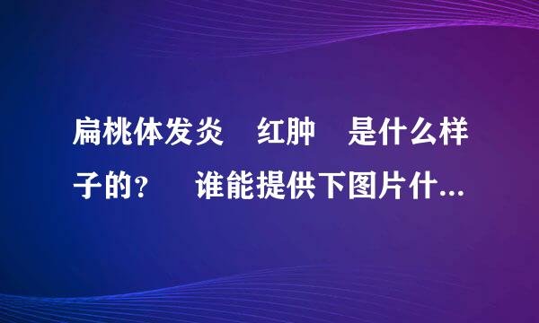 扁桃体发炎 红肿 是什么样子的？ 谁能提供下图片什么的 供参考 谢谢