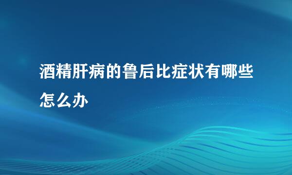 酒精肝病的鲁后比症状有哪些怎么办