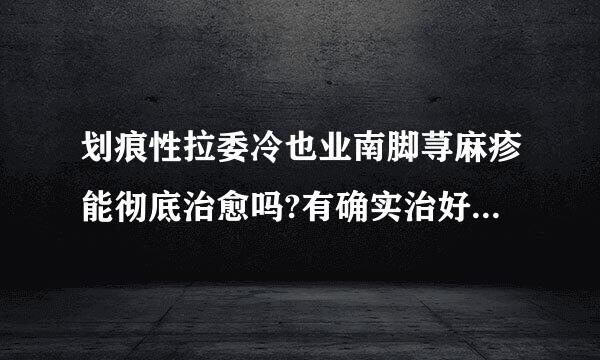 划痕性拉委冷也业南脚荨麻疹能彻底治愈吗?有确实治好过的人吗?