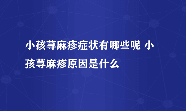 小孩荨麻疹症状有哪些呢 小孩荨麻疹原因是什么