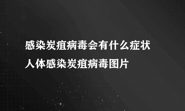 感染炭疽病毒会有什么症状 人体感染炭疽病毒图片