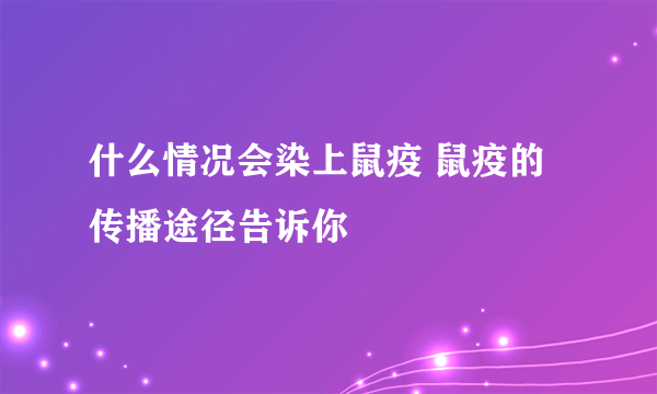 什么情况会染上鼠疫 鼠疫的传播途径告诉你