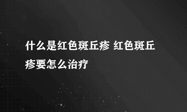 什么是红色斑丘疹 红色斑丘疹要怎么治疗