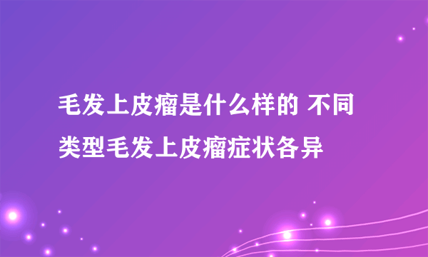 毛发上皮瘤是什么样的 不同类型毛发上皮瘤症状各异