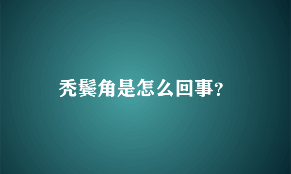 秃鬓角是怎么回事？