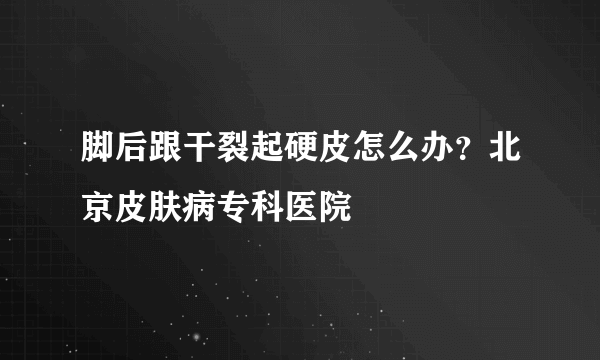 脚后跟干裂起硬皮怎么办？北京皮肤病专科医院