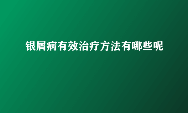 银屑病有效治疗方法有哪些呢