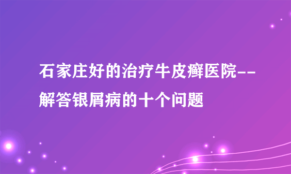 石家庄好的治疗牛皮癣医院--解答银屑病的十个问题