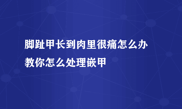 脚趾甲长到肉里很痛怎么办 教你怎么处理嵌甲