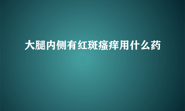 大腿内侧有红斑瘙痒用什么药