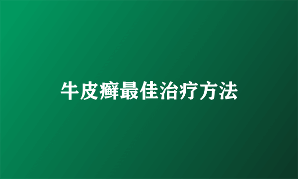 牛皮癣最佳治疗方法