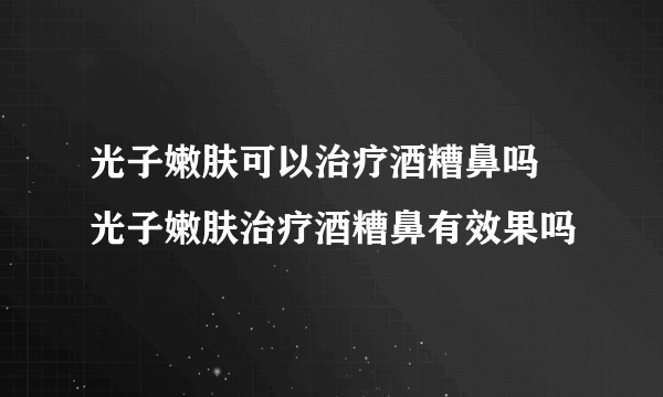 光子嫩肤可以治疗酒糟鼻吗 光子嫩肤治疗酒糟鼻有效果吗