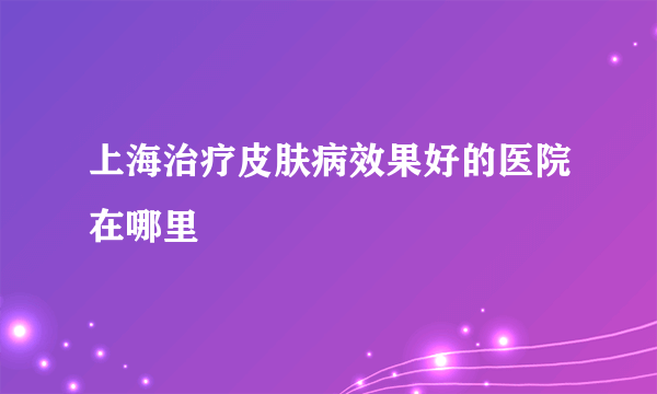 上海治疗皮肤病效果好的医院在哪里