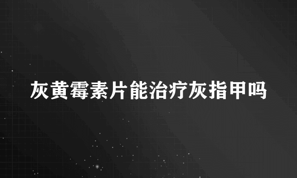 灰黄霉素片能治疗灰指甲吗