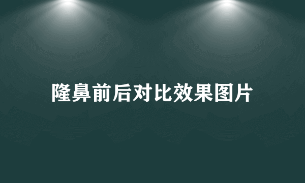 隆鼻前后对比效果图片