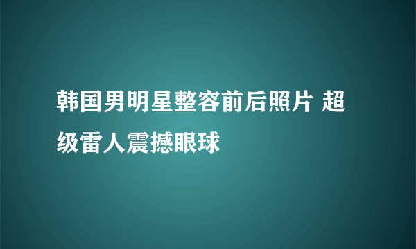 韩国男明星整容前后照片 超级雷人震撼眼球