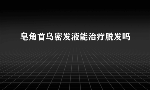 皂角首乌密发液能治疗脱发吗